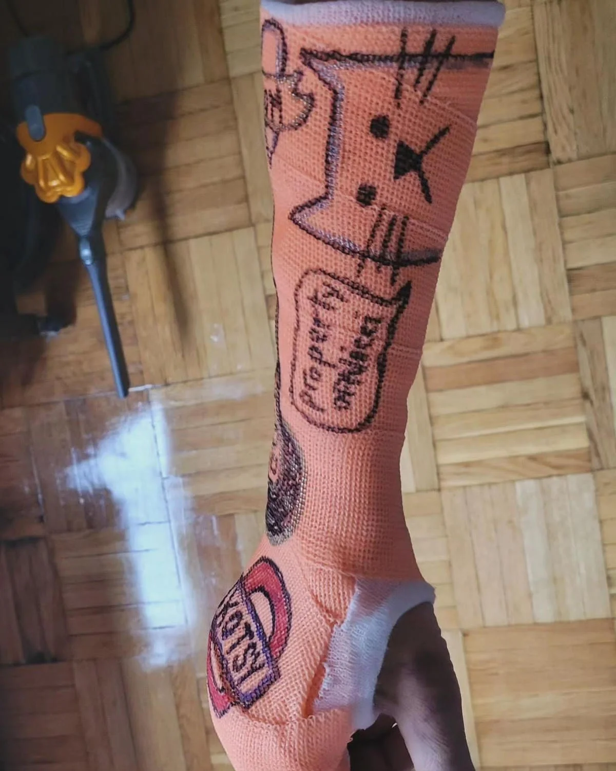 Top down view of orange arm and hand cast with artwork on it